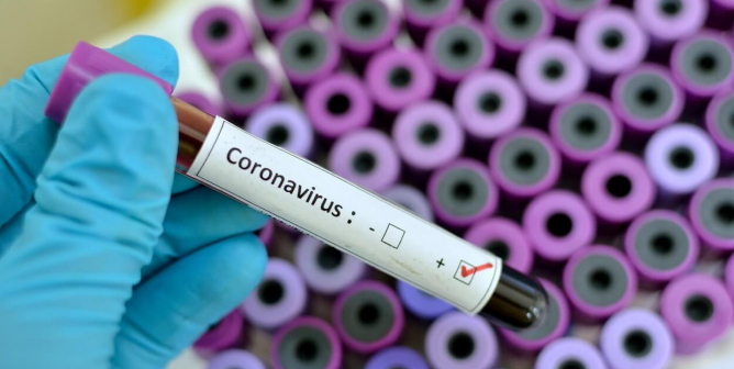 Coronavirus positive sample