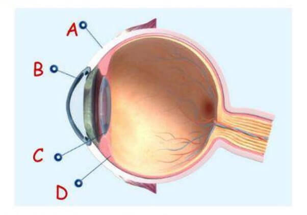 Humane eyeball dissection screenshot from the PDF Virtual Eye Lab.