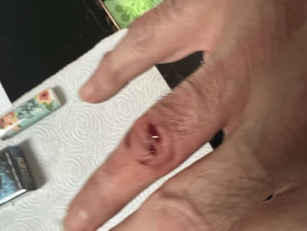 ZWF Miami owner's hand bleeds after being bitten by a Gila monster